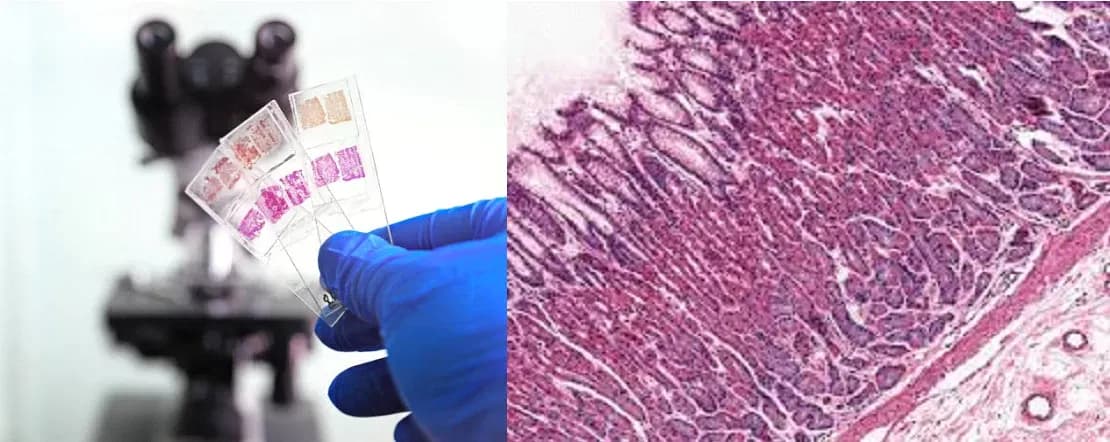 AI-driven Approach to Etiology Classification