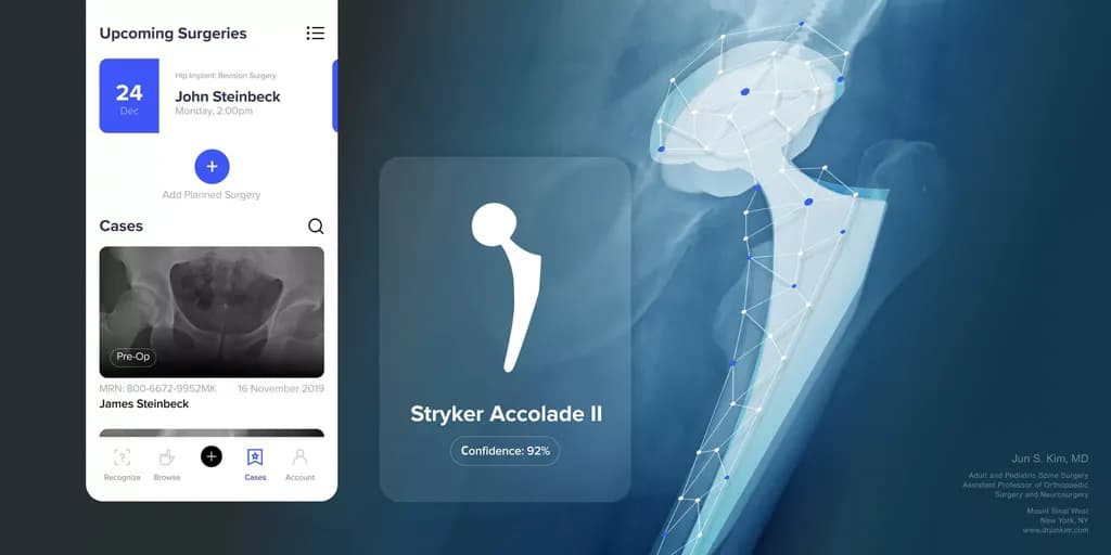 AIdentyfy - AI-powered implant identification